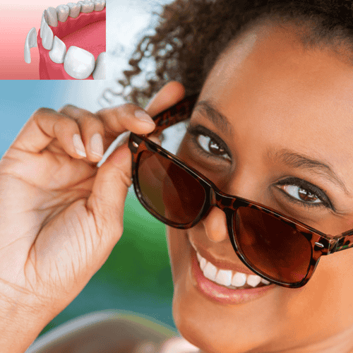 World‑Class Dental Veneers in Los Algodones, Mexico