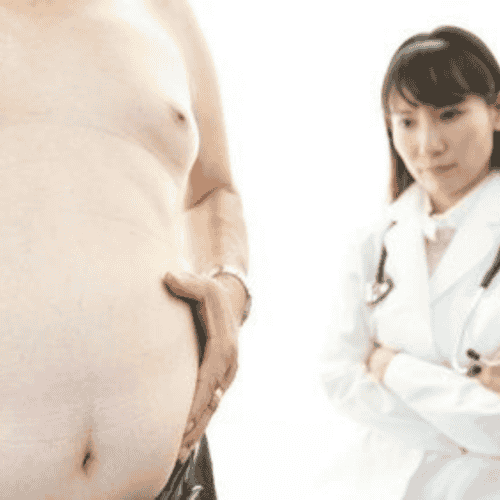 Top Package for Mini Gastric Bypass in Merida, Mexico - $6800