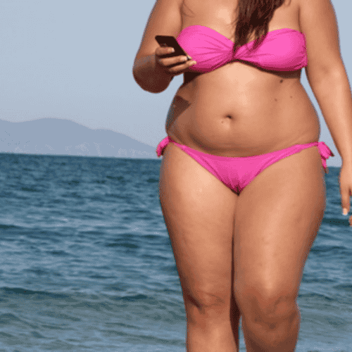 Best Package for Lap Band Surgery in Merida, Mexico - $5300