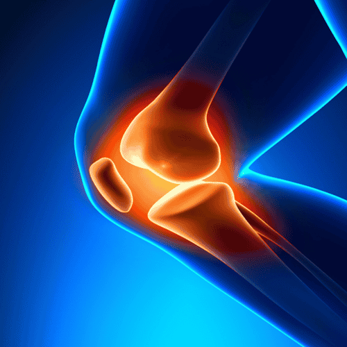 Stem Cell Therapy for Joints in Mexico City Mexico at MexStemCells Clinic