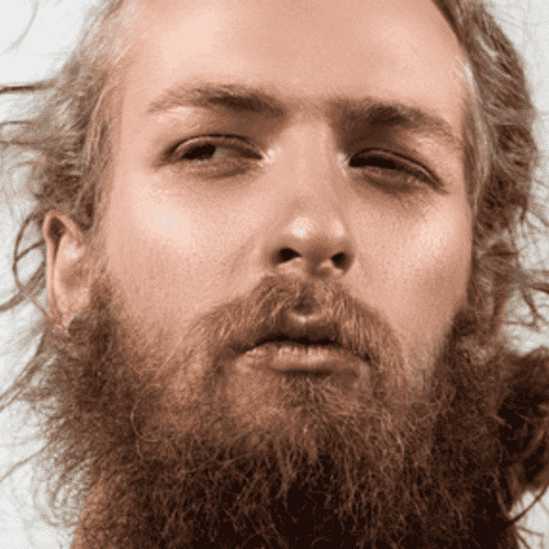 Stem Cell Therapy for Hair Loss Treatment Package in Europe and Asia