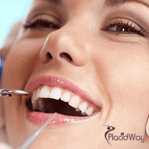 Affordable Package for Tooth Replacement in Costa Rica - $700