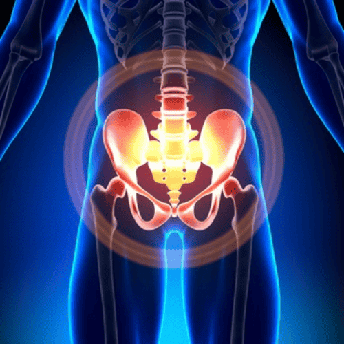 Best Package for Hip Replacement in Tijuana, Mexico