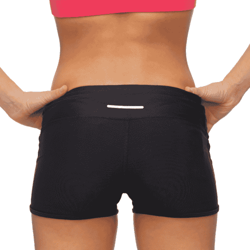 Brazilian Butt Lift BBL with Liposuction in Mexicali, Mexico