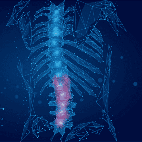 Affordable Inguinal Hernia Surgery in Mexicali, Mexico