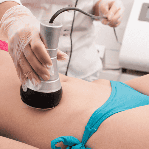 Best Liposuction Package in Bogota, Colombia