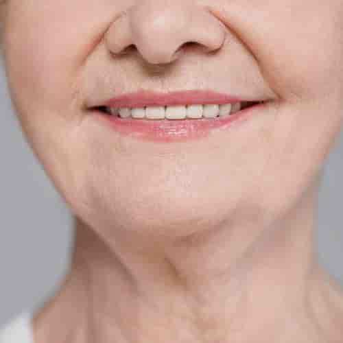 Best Full Mouth Restoration Mexico Package for Missing Teeth by All on X Dental Studio