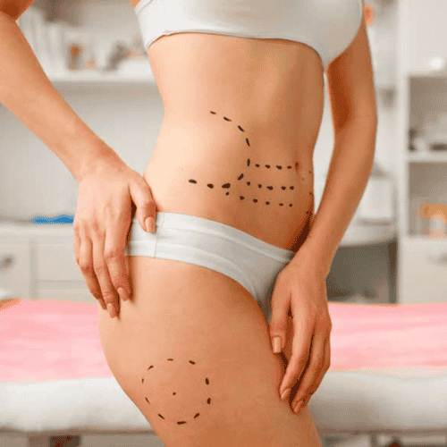 CIPLA Clinic Mommy Makeover in Santo Domingo, Dominican Republic