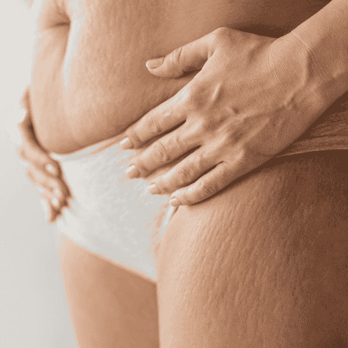 Gastric Bypass Package by Costamed in Cancun, Mexico