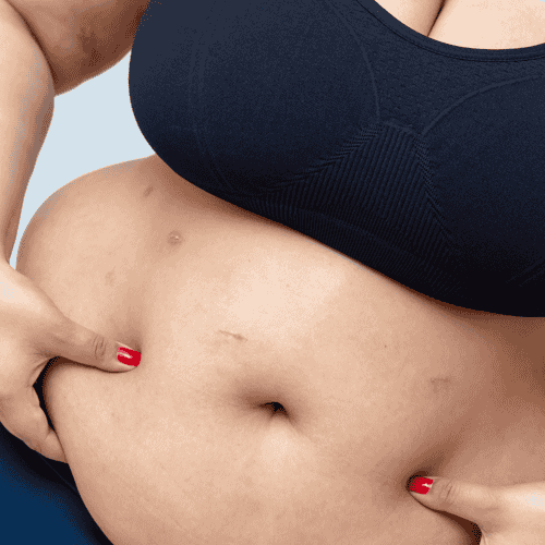 Laparoscopic Gall Bladder Removal in Tijuana, Mexico