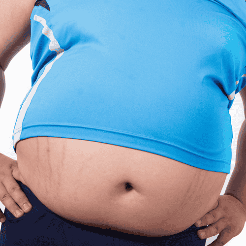 Laparoscopic Myomectomy in Florence, Italy