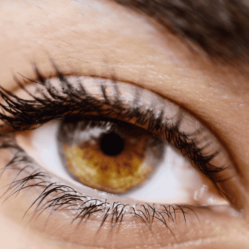 First‑Class Glaucoma Surgery in Florence, Italy