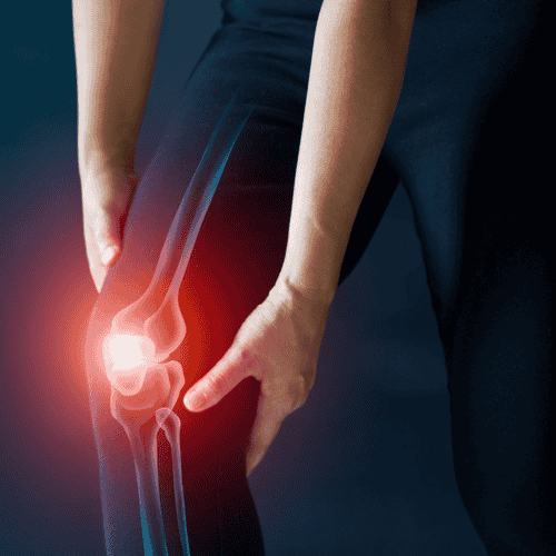 Stem Cells Dominican Republic: Osteoarthritis Treatment by Dr. Vargas Decamps in Santo Domingo