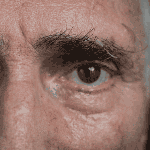 Live Cell Therapy for Retinitis Pigmentosa in Mexico