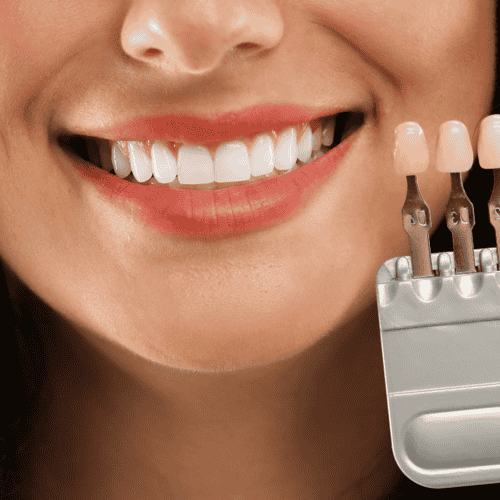 Smile makeover in Istanbul - Hollywood smile, implants, crowns in Istanbul