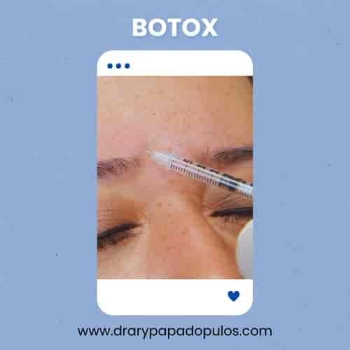 Botox Package at Dr. Ary Papadopulos - Plastic Surgery in Mexico City, Mexico City, Mexico