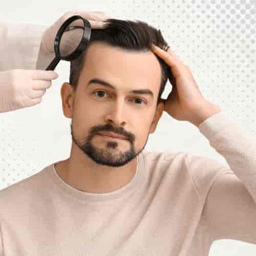 Hair Transplantation Package in Malta by St. Mary’s Clinic