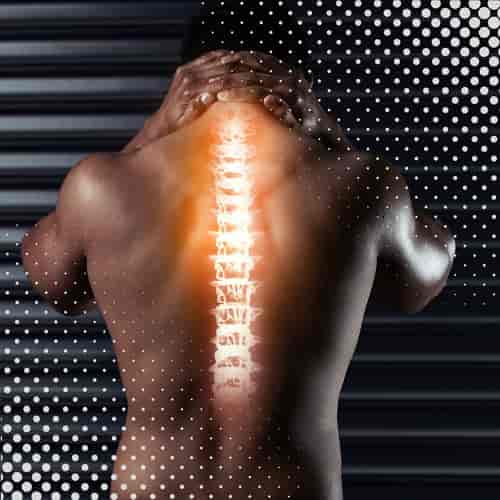 Stem Cell Therapy for Herniated Discs Package in Santo Domingo, Dominican Republic by Dr. Vargas Decamps