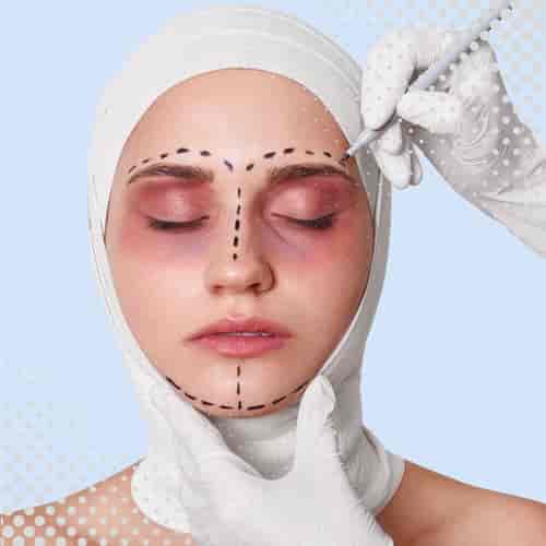 Brow Lift Package in Yerevan, Armenia by Boroyan Plastic Surgery