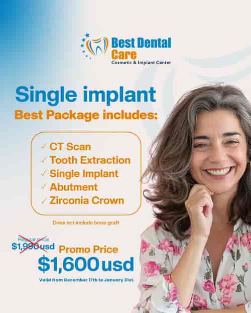 Limited-Time Dental Implant Promotion