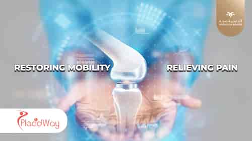 Joints Replacements procedures