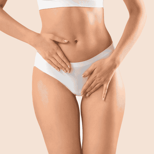 Liposuction Package in Guadalajara, Mexico by PARS