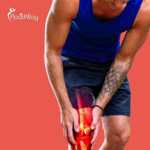 Stem Cell Therapy for Chronic Recurrent Multifocal Osteomyelitis Package in Cabo San Lucas, Mexico