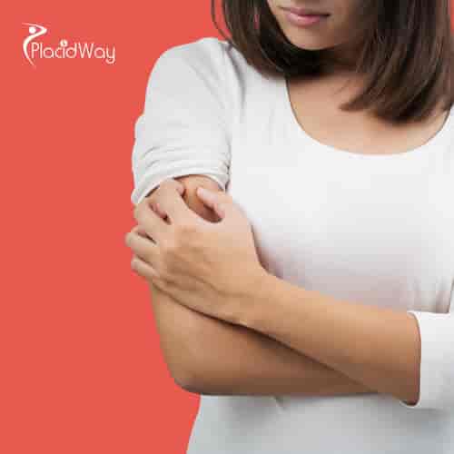 Alternative Basal Cell Carcinoma Treatment Package in Tijuana, Mexico by ITC