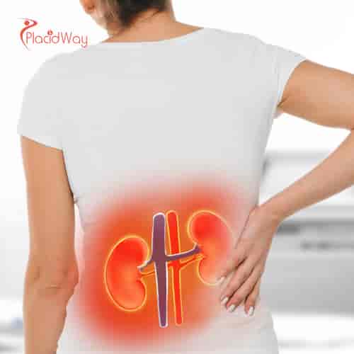 Stem Cell Therapy for Kidney Failure in Mexico City by MexStemCells Clinic