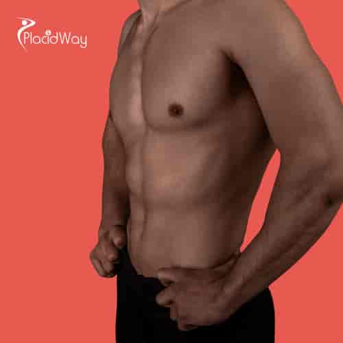 KCM Clinic Brings Best Gynecomastia Package in Jelenia Gora, Poland