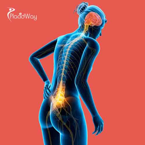 Best Percutaneous Laser Disc Decompression Package in Italy