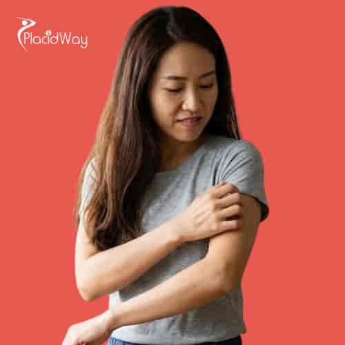 Psoriasis Treatment Package in Tijuana, Mexico by ITC