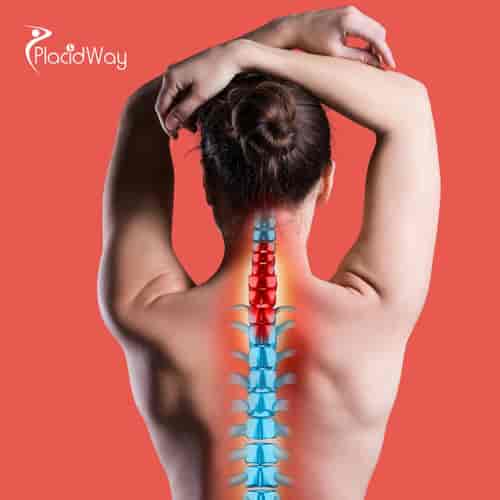 Stem Cell Treatment for Spinal Cord Injury Package in Cali, Colombia by Stem Cells Kyron