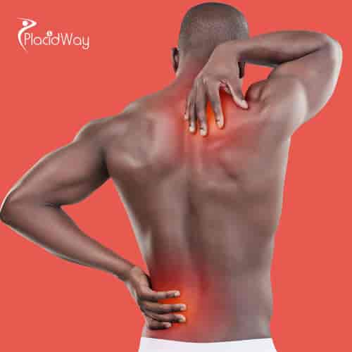 Stem Cell Treatment for Degenerative Disc Disease Package in Cali, Colombia by Stem Cells Kyron