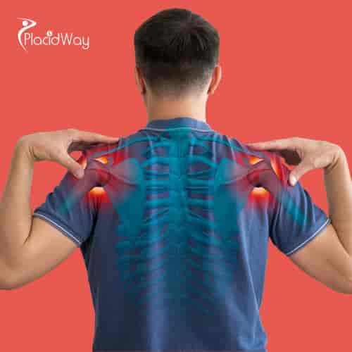 Stem Cell Therapy for Shoulder Injury Package in Tijuana, Mexico by CellsTime Clinique
