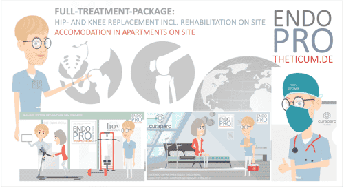 Full-Treatment-Package: Expert Hip & Knee Replacement in Mainz, Germany with Rehabilitation included!