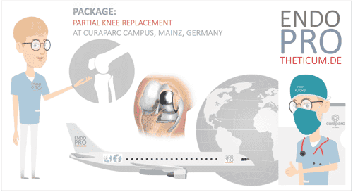 Partial Knee Replacement in Mainz, Germany (20 minutes from Frankfurt Airport)