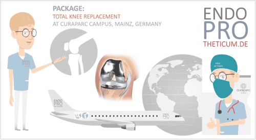 Total Knee Replacement in Mainz, Germany (20 minutes from Frankfurt Airport)