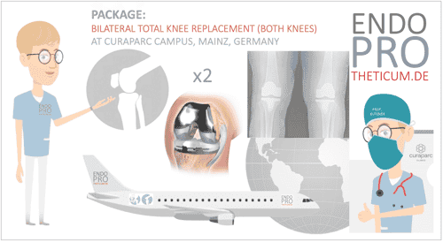Bilateral Total Knee Replacement in Mainz, Germany (20 minutes from Frankfurt Airport)