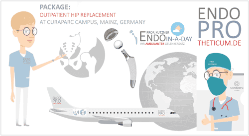 ENDO-in-a-day: Total Hip Replacement as an outpatient in Mainz, Germany (20 minutes from Frankfurt Airport)