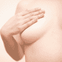 Breast Augmentation in Seoul, Korea by JK Plastic Clinic