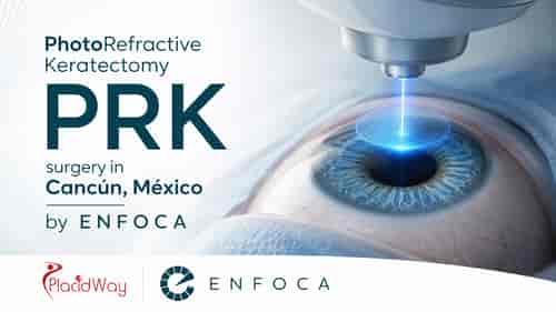 PRK Eye Surgery in Cancun by ENFOCA