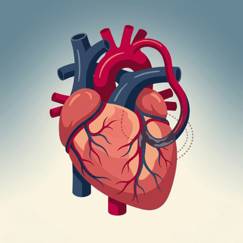 Coronary Artery Bypass Surgery Package at Heartline Clinics in Santo Domingo, Dominican Republic