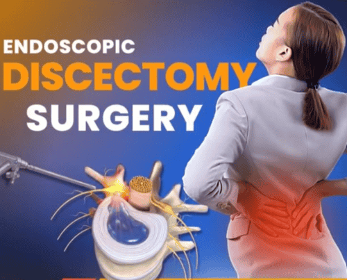 Endoscopic Discectomy Surgery in Bursa/İstanbul, Turkey