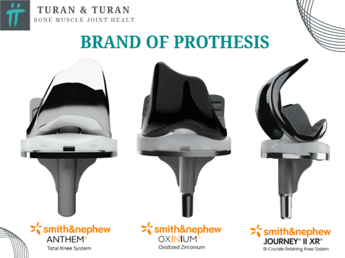 Robotic Knee Replacement Surgery in Istanbul, Turkey by Turan Turan