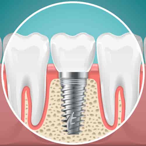 Marietta Dental Care
