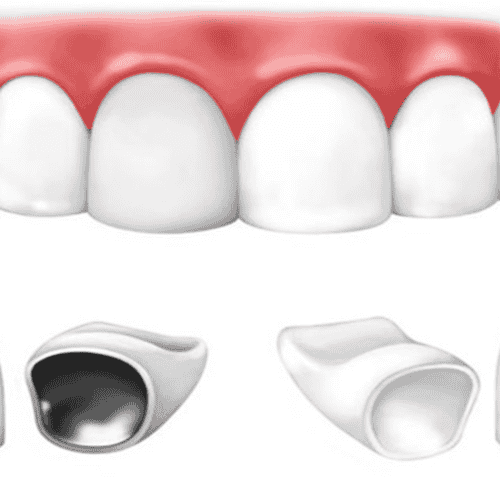 Americas Dental Care