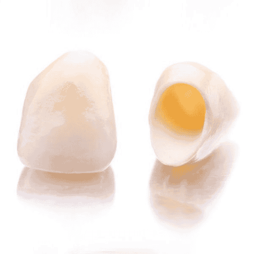 Dental Crowns at Simply Dental Los Algodones Mexico
