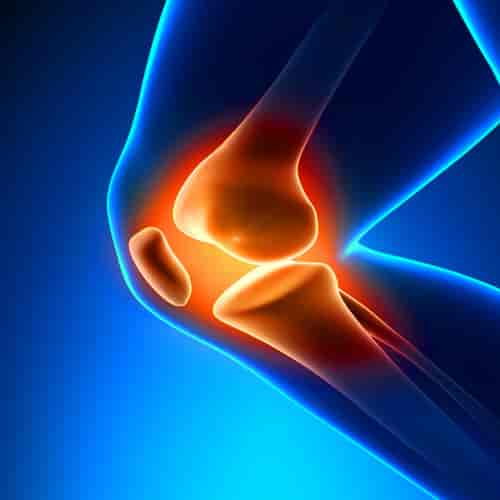 Stem Cell Therapy for Joints in Mexico City Mexico at MexStemCells Clinic