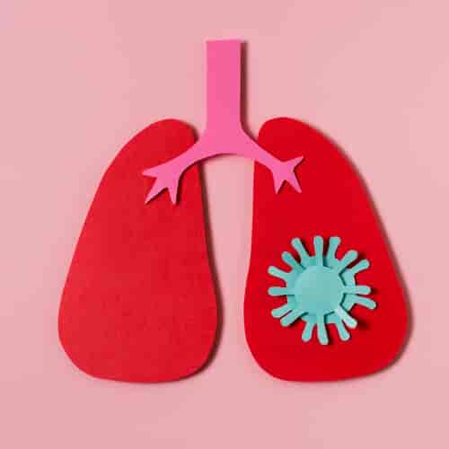 Price Comparison for Stem Cell Therapy for COPD in Mexico